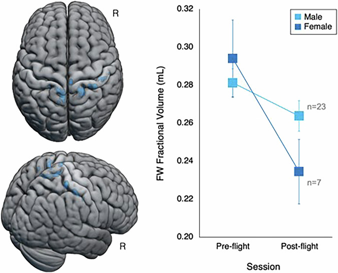 Crewmember demographic factors and their association with brain and ocular changes following spaceflight.