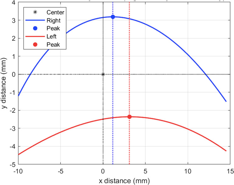 Comparison of eyelid contour symmetry after ptosis repair via centralized versus temporally biased levator suturing techniques.