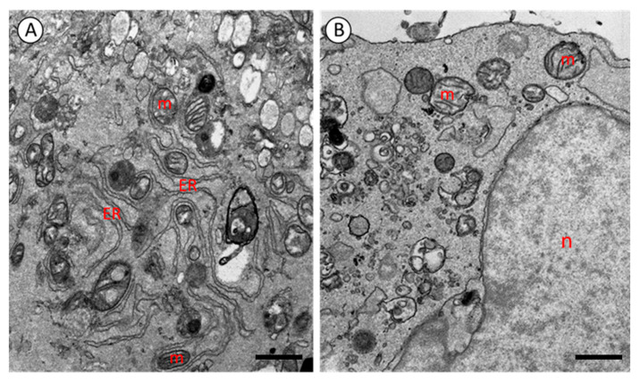 An Optimized Protocol for SBEM-Based Ultrastructural Analysis of Cultured Human Cells.