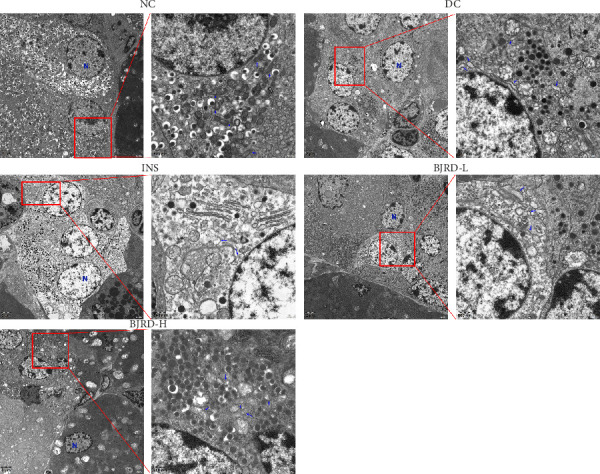 Baihu Jia Renshen Decoction Improves Type 1 Diabetic Rats by Modulating Metabolic Profile.