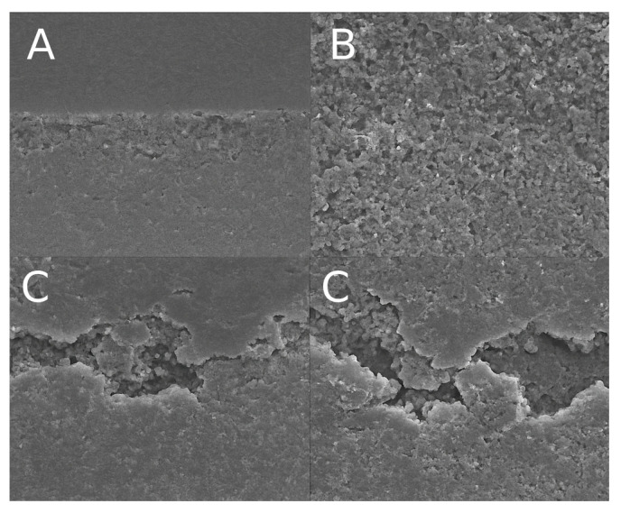 Bonding to Demineralized Dentin: Impact of Immediate and Delayed Dentin Sealing over Time.