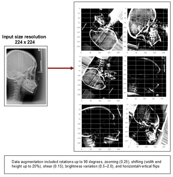 Development and evaluation of a convolutional neural network model for sex prediction using cephalometric radiographs and cranial photographs.