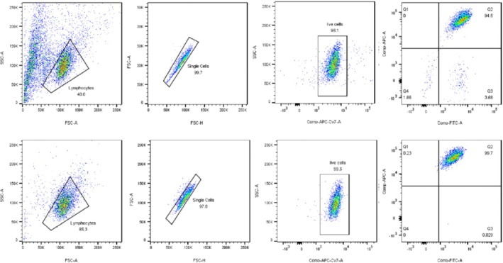 A Preliminary Study on the Therapeutic Role of γδT Cells in Triple-Negative Breast Cancer.