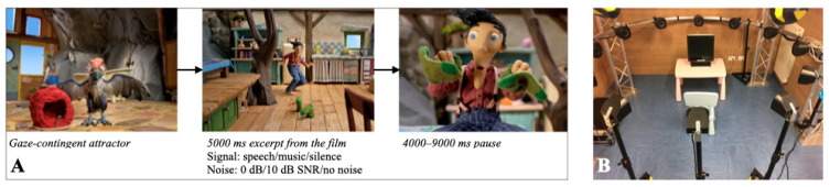 Is Pupil Response to Speech and Music in Toddlers with Cochlear Implants Asymmetric?