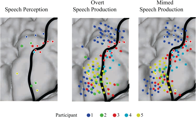 Don't put words in my mouth: speech perception can falsely activate a brain-computer interface.