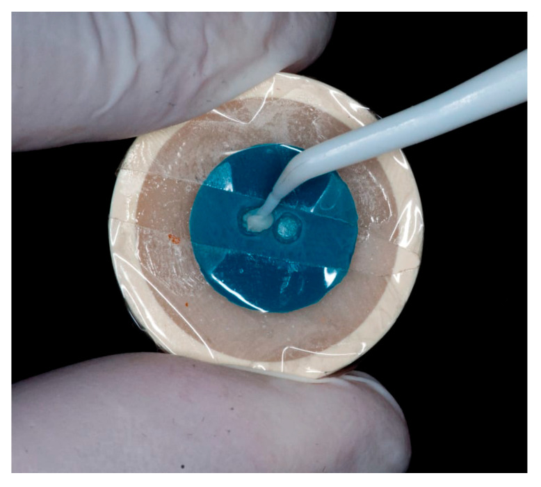Bonding to Demineralized Dentin: Impact of Immediate and Delayed Dentin Sealing over Time.