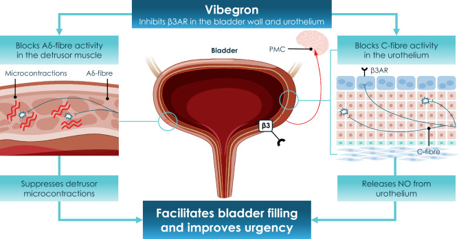 Vibegron in overactive bladder: a comprehensive review of efficacy, safety and patient-reported outcomes.