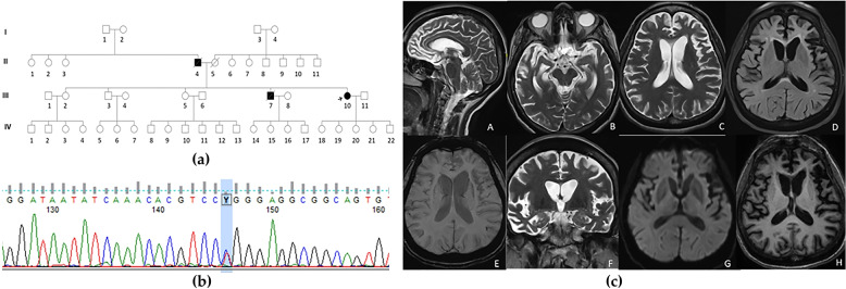 Clinical profile, atrophy and inheritance patterns of pathogenic MAPT gene mutations in Frontotemporal dementia detected using whole exome sequencing: a single-center first report from India.