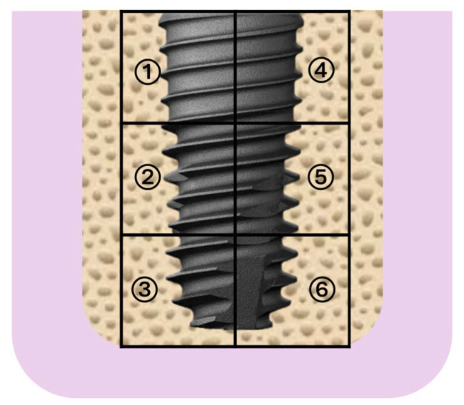 Evaluation of Hydroxyapatite-β-Tricalcium Phosphate Collagen Composites for Socket Preservation in a Canine Model.