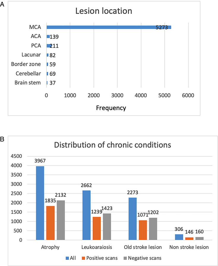 Development of a deep learning method to identify acute ischaemic stroke lesions on brain CT.