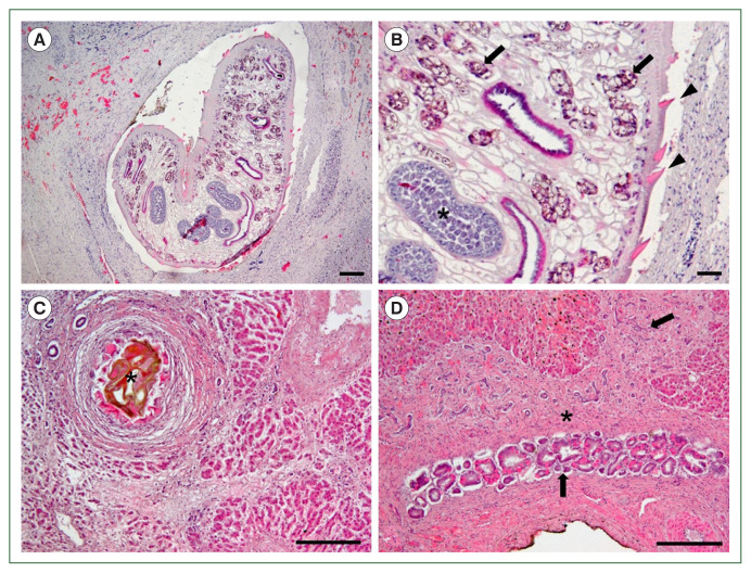 Fasciola hepatica infection in Korean water deer (Hydropotes inermis argyropus).