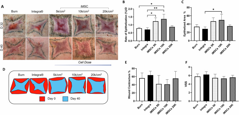 Human iPSCs-derived mesenchymal stem cells promote skin regeneration and burn wound healing.