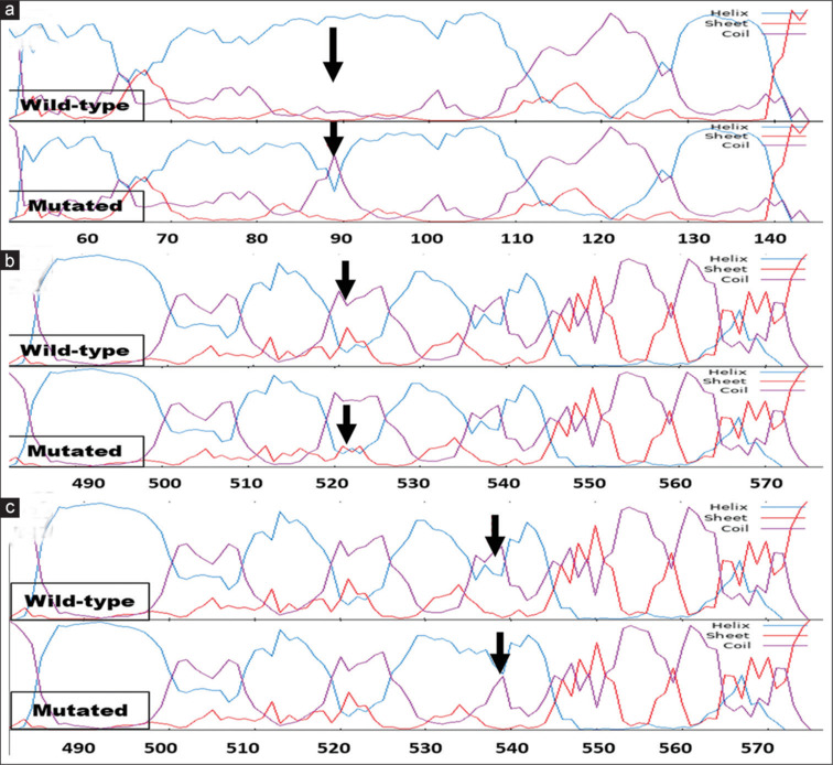 Paucity of optineurin gene variants in Indian juvenile open-angle glaucoma patients.