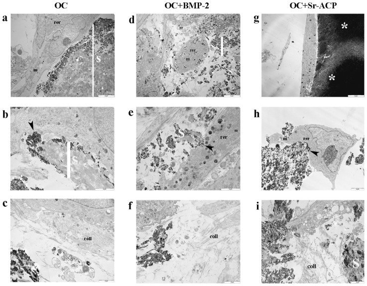 Enhanced Osteogenic Response to an Osteochondral Scaffold Modified with BMP-2 or Strontium-Enriched Amorphous Calcium Phosphate in a Co-Culture In Vitro Model.