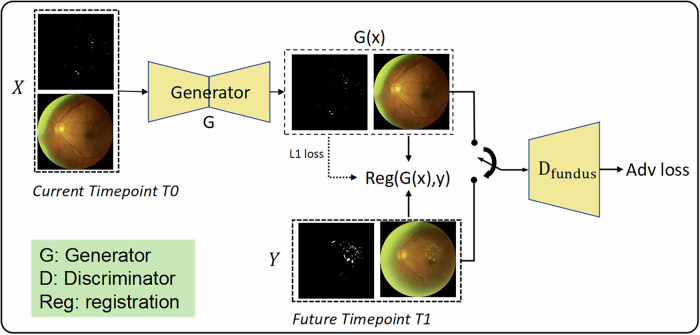 Forecasting the diabetic retinopathy progression using generative adversarial networks.