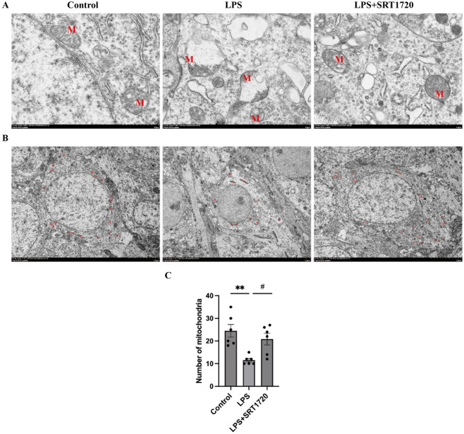 SRT1720 ameliorates LPS-induced depressive-like behaviors in mice and activates Parkin-mediated mitophagy.