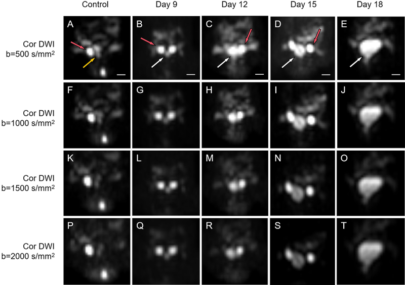 The dynamic changes in quantitative parameters of diffusion-weighted imaging at different b-values in a prostate cancer mouse model and their correlation with histopathology parameters.