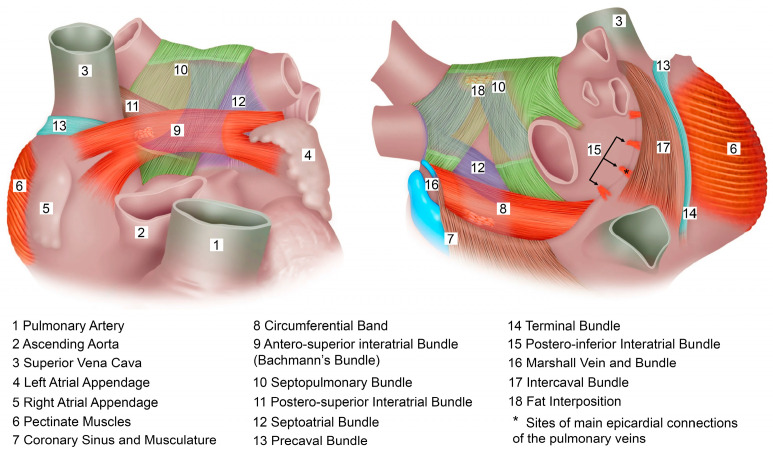 Hybrid Ablation in Atrial Fibrillation: Bridging Mechanistic Understanding and Clinical Practice.