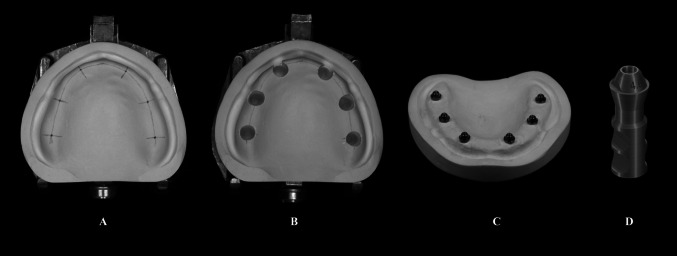 Accuracy of one-versus two-phase photogrammetry implant impression system: an in-vitro study.