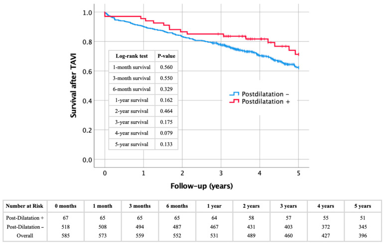 Importance of Imaging Assessment Criteria in Predicting the Need for Post-Dilatation in Transcatheter Aortic Valve Implantation with a Self-Expanding Bioprosthesis.