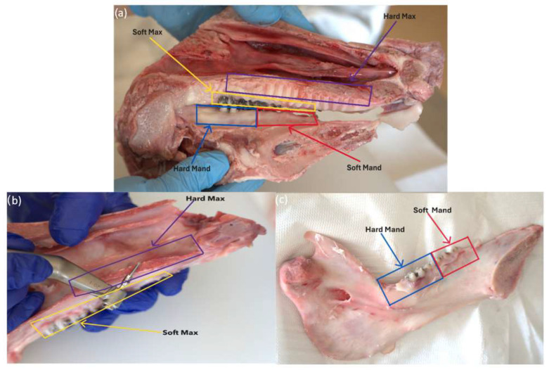 Analysis of Insertion Torque of Orthodontic Mini-Implants Depending on the System and the Morphological Substrate.