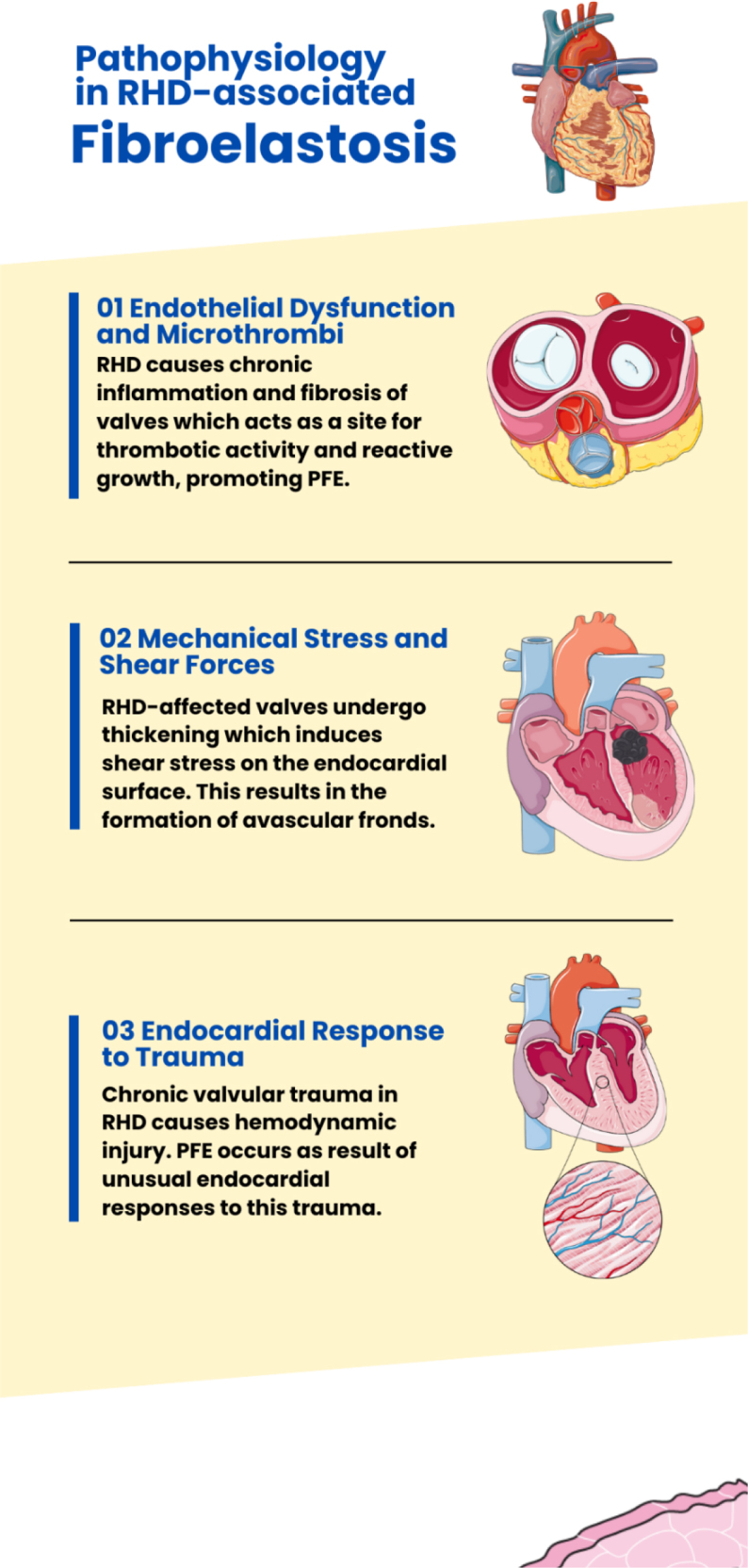 A tale of two valves: where rheumatic mitral disease meets aortic papillary fibroelastoma - a narrative review.