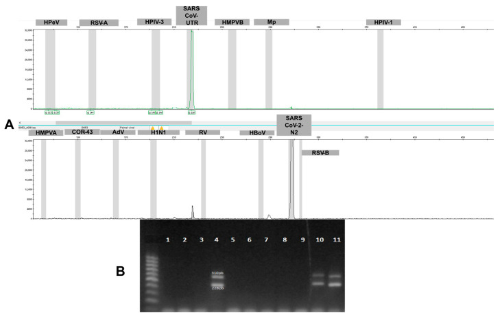 Detection of Microorganisms Causing Human Respiratory Infection Using One-Tube Multiplex PCR.