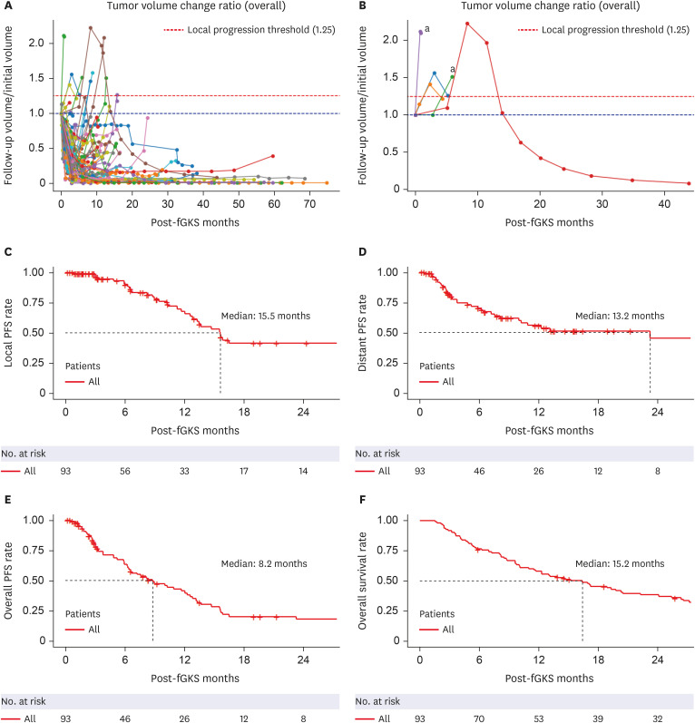 Fractionated Gamma Knife Radiosurgery as a Primary Treatment for Large Brain Metastases.