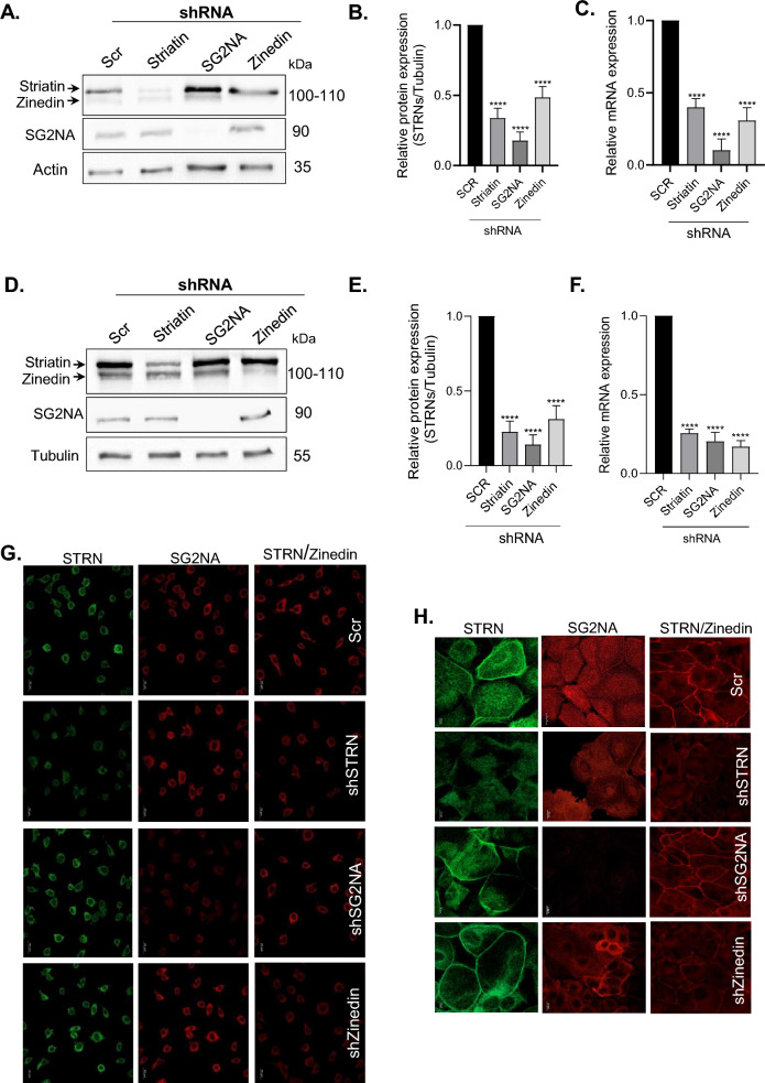 The role of the striatin family proteins in hippo signaling and cellular regulation.