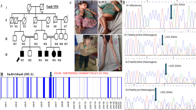 Identification of a Novel GRM1 Frameshift Variant in Two Pakistani Families Broadens the Genetic Landscape of Ultra-Rare Spinocerebellar Ataxia Type 13.