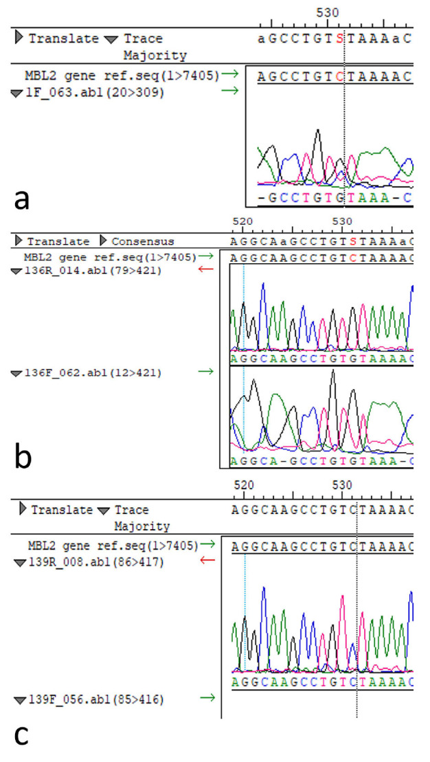 Impact of Sociodemographic, Clinical, and Genetic Factors and <i>Fusobacterium nucleatum</i> on Premature Birth Outcomes in Women from Kazakhstan: A Case-Control Study.