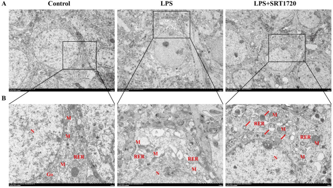 SRT1720 ameliorates LPS-induced depressive-like behaviors in mice and activates Parkin-mediated mitophagy.