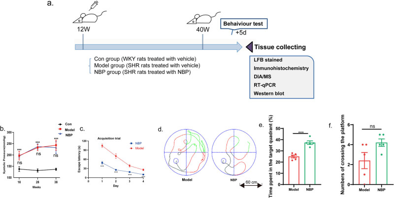 DIA-based proteomics reveals anti-inflammatory role of DL-3-<i>n</i>-butylphthalide in cerebral small vessel disease-induced brain injury in hypertensive rat.