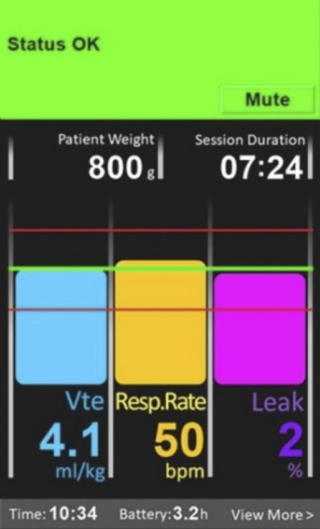 Implementation of a brief training programme to reduce mask leak with a respiratory function monitor.