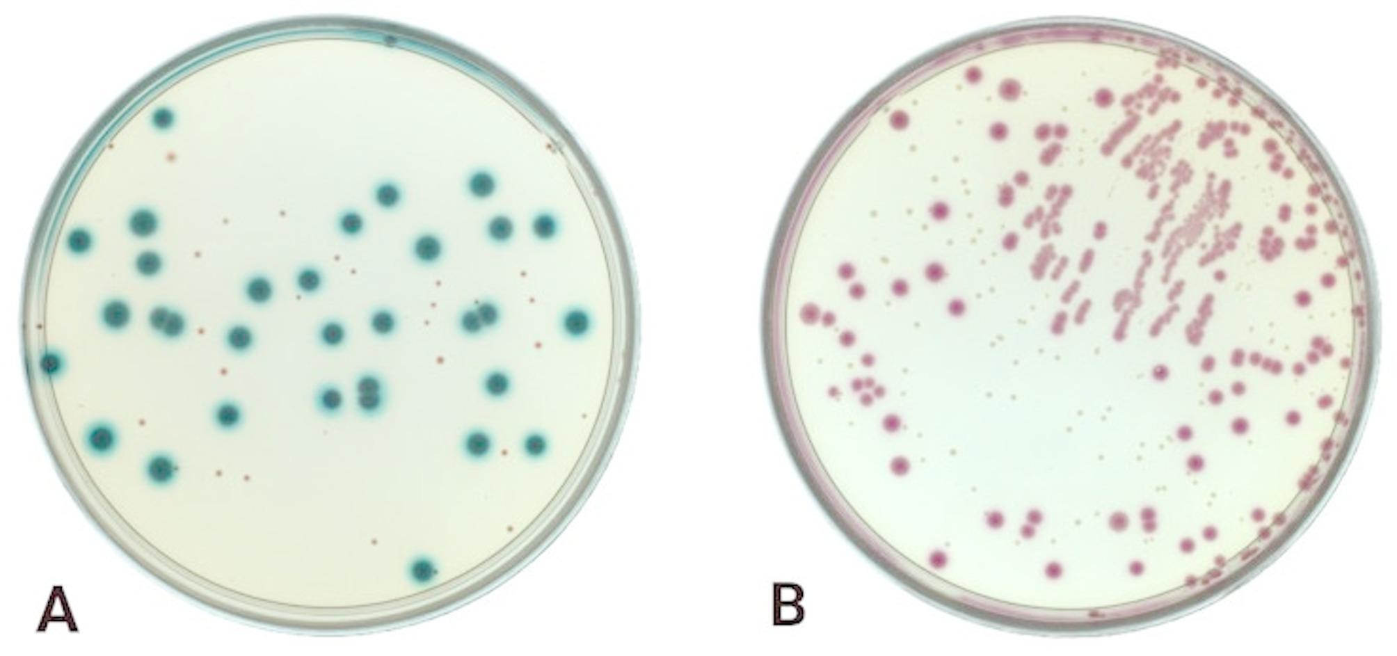 Phylogenetic characterisation, virulence factors, and multi-drug resistance of Escherichia coli strains isolated from faeces of feral pigeons (Columba Livia forma urbana).