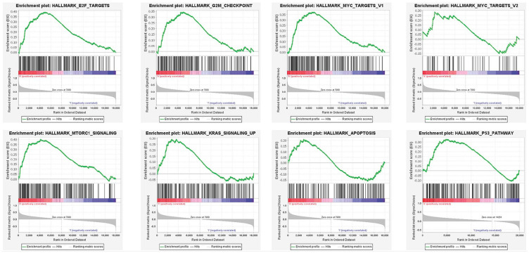 <i>NAT2</i>: A Novel Target in Intrahepatic Cholangiocarcinoma and its Role in Modulating Tumor Behavior.