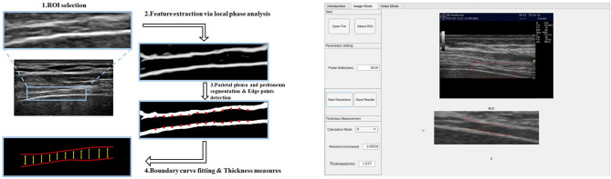 A novel methodology for measuring global diaphragm thickness by ultrasonography in patients with critical illness: an exploratory pilot study.