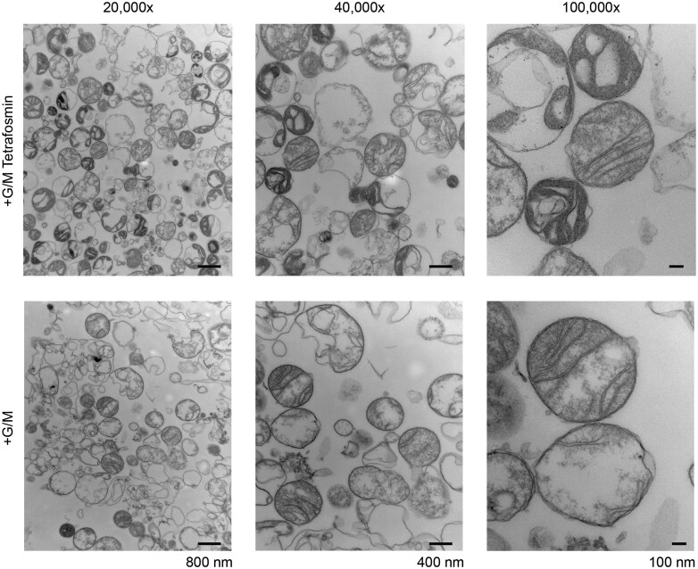 Radiolabeling isolated mitochondria with Tc-99m: A first-in-field protocol and early feasibility findings.