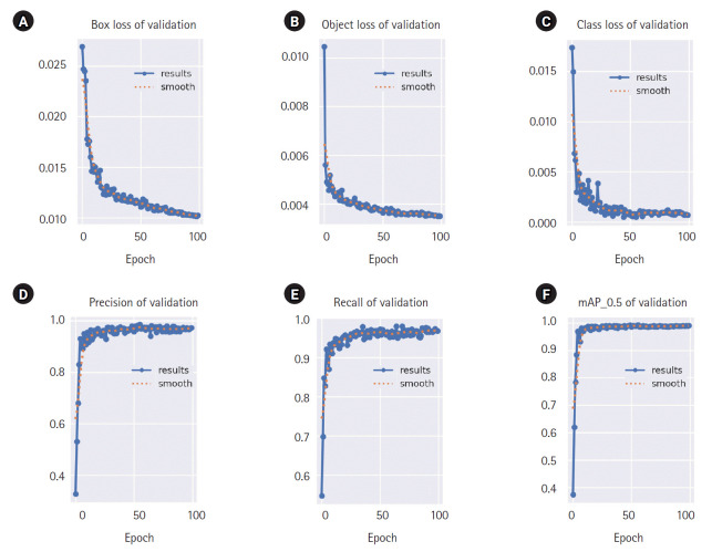 Deep learning-based model for detection of intracranial waveforms with poor brain compliance in southern Thailand.