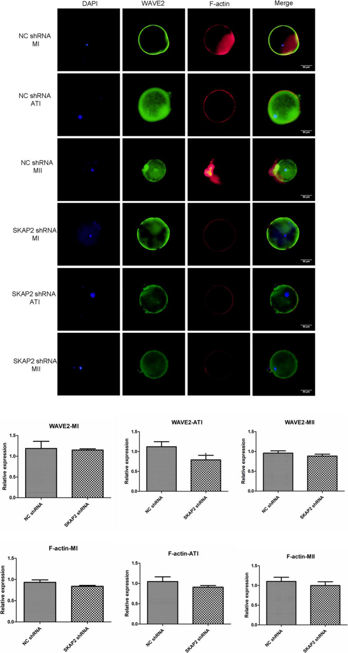 Expression and Regulatory Roles of SKAP2 and Cortactin in Mouse Ovarian Tissue and Oocyte Maturation.