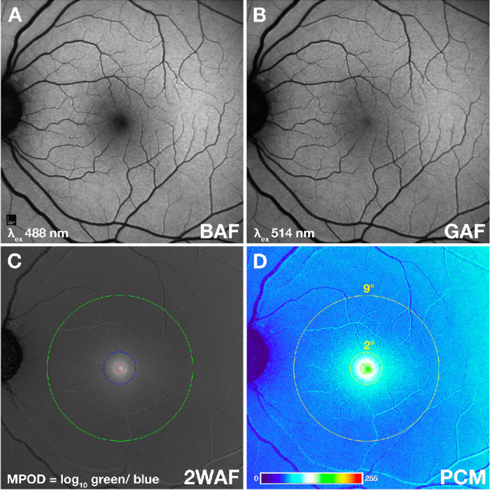 Advanced Analysis Tools for Two Wavelength Autofluorescence Imaging of Macular Xanthophyll Carotenoids: ALSTAR2 Baseline.