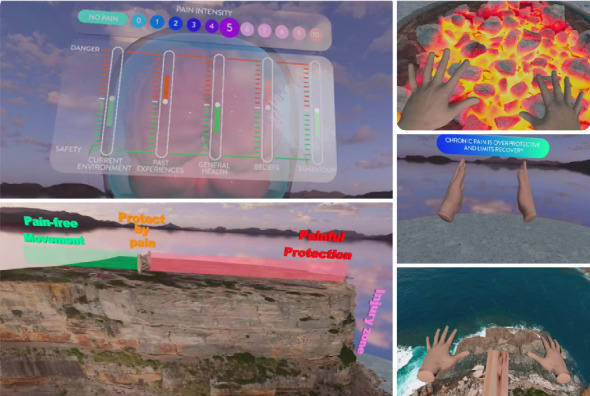 Expectations for Adopting Virtual Reality to Promote Health Literacy in Patients With Persistent Pain: Qualitative Analysis of UK-Based Physiotherapists.