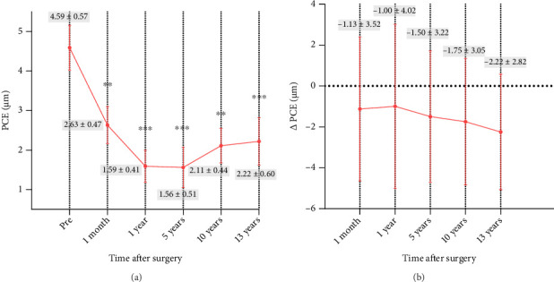 Thirteen-Year Outcomes of Keratorefractive Lenticule Extraction for Myopia Up to -10 Dioptres.