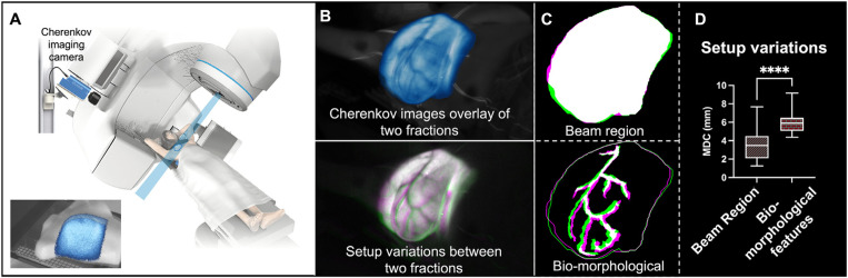Cherenkov Imaged Bio-Morphological Features Verify Patient Positioning With Deformable Tissue Translocation in Breast Radiation Therapy.