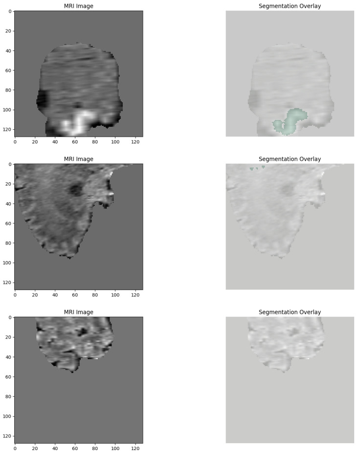 A Web-Deployed, Explainable AI System for Comprehensive Brain Tumor Diagnosis.