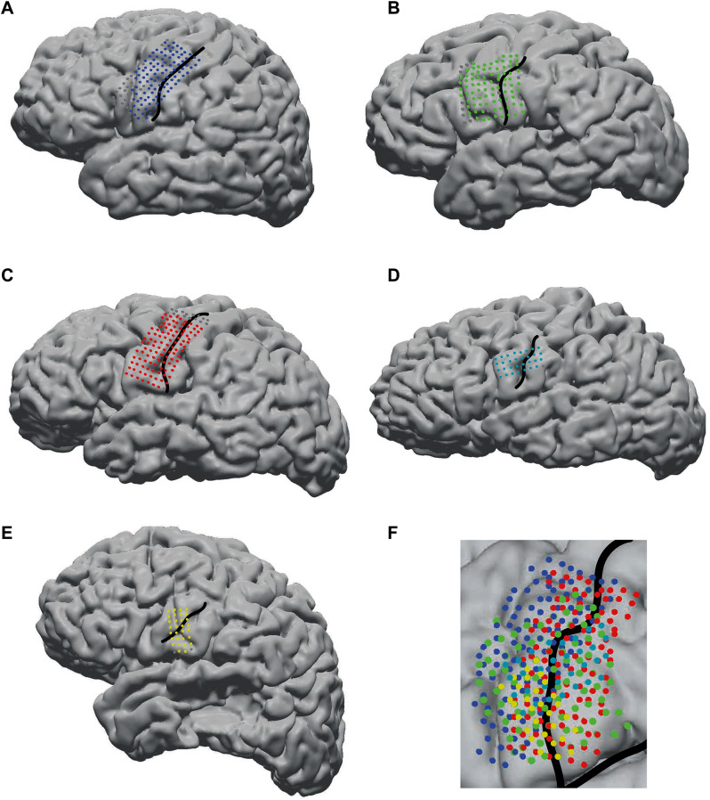 Don't put words in my mouth: speech perception can falsely activate a brain-computer interface.