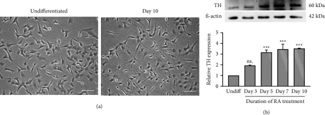 Alpha-Mangostin Alleviates Mitochondrial Damage and Autophagy Dysregulation in the MPP<sup>+</sup> Cellular Model of Parkinson's Disease.