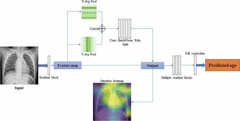 Predicting pediatric age from chest X-rays using deep learning: a novel approach.