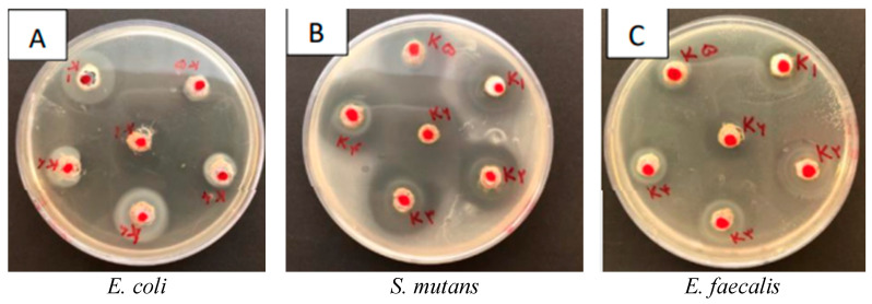 Antibacterial Characteristics of Nanoclay-Infused Cavit Temporary Filling Material: In Vitro Study.