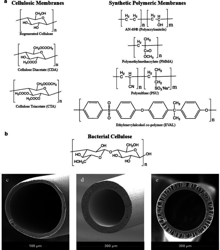 Biocompatibility in hemodialysis: artificial membrane and human blood interactions.